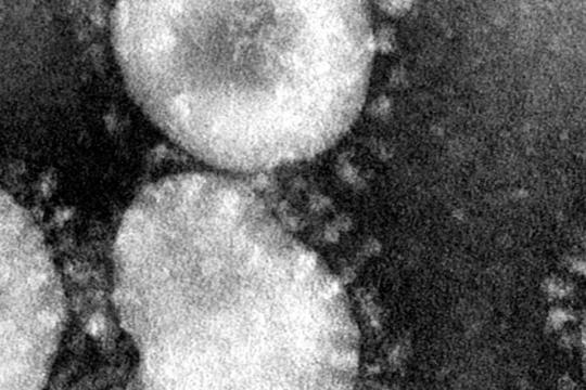 Coronaviruses. Photo credit: Dr. Fred Murphy/Centers for Disease Control and Prevention's Public Health Image Library (PHIL), with identification number #4814. 